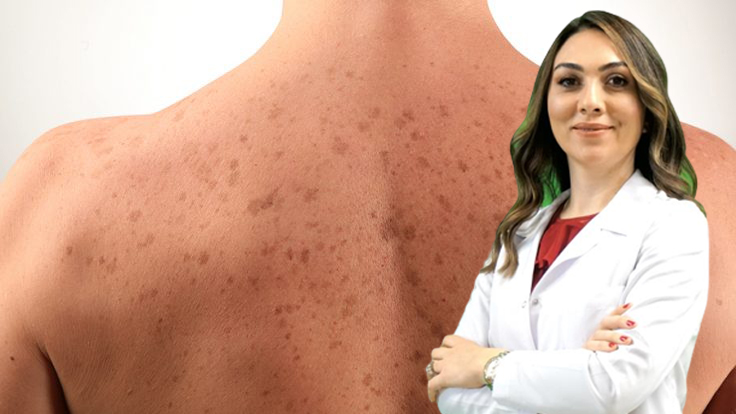 Skin spots find healing in expert hands